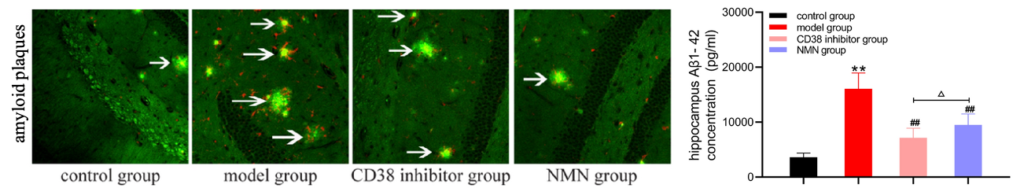 NMN and CD38 Inhibition Rid the Brain of A beta.