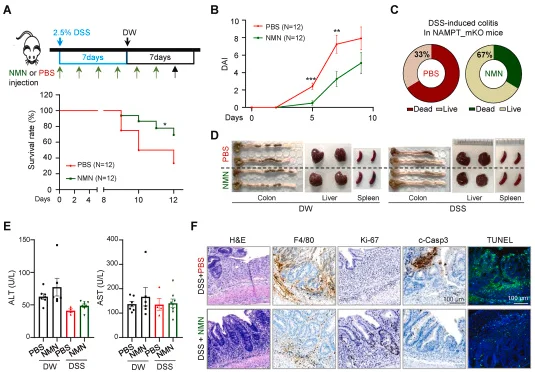 NMN supplementation protects mice from inflammatory bowel disease NMN supplementation protects mice from inflammatory bowel disease