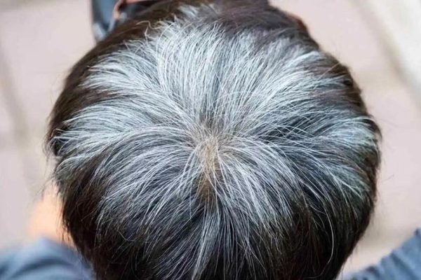 Can NMN turn white hair black?