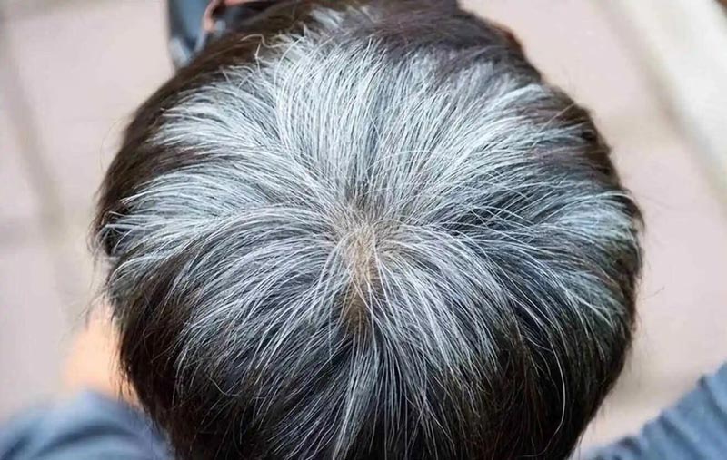 Can NMN turn white hair black?