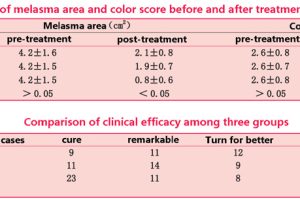 Tranexamic acid combined with glutathione compound water light whitening spot should be how to match?