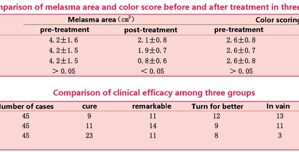 Tranexamic acid combined with glutathione compound water light whitening spot should be how to match?