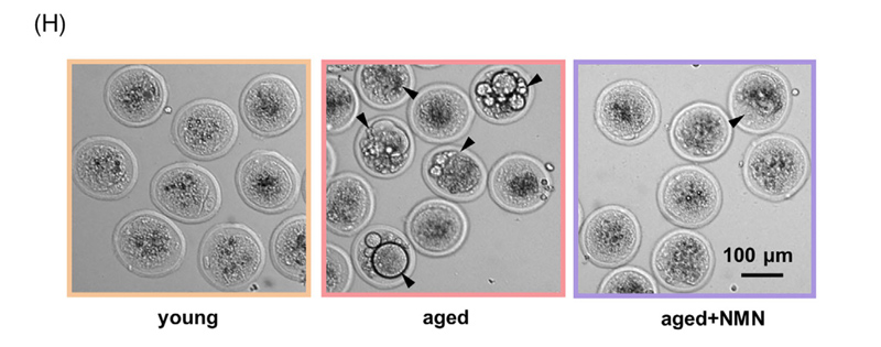 The black arrows indicate oocyte abnormalities, and NMN significantly reduced oocyte abnormalities in older mice