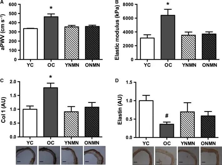 NMN relieves atherosclerosis