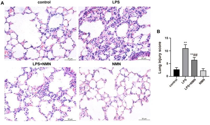 NMN alleviates endotoxin-induced acute lung injury