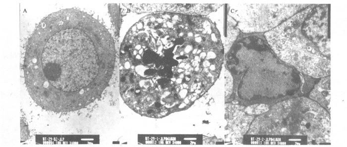 Detection of curcumin-induced apoptosis of HT-29 cells by transmission electron microscopy (×4000)