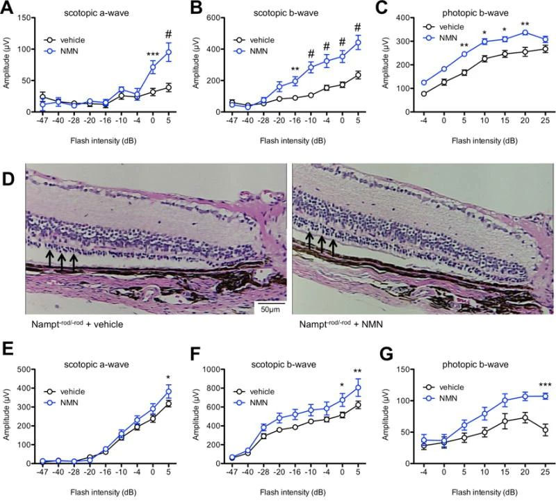 Protective effect of exogenous NMN on retina