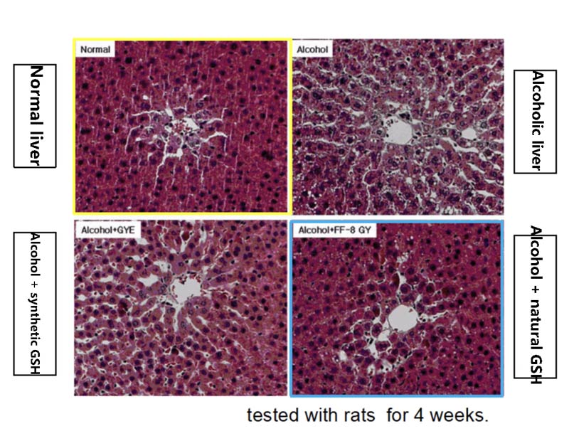 Can save liver damage glutathione, can anti-aging whitening really?