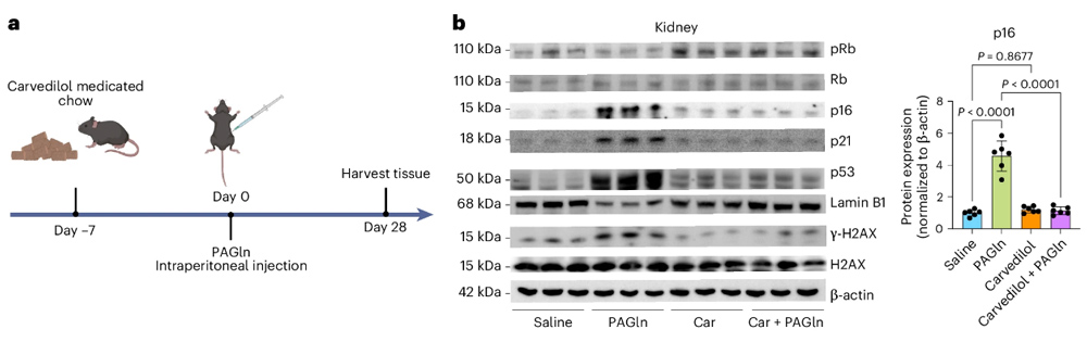 Fudan University found that this metabolite of gut flora can accelerate aging