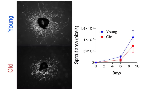 Blood vessel formation is impaired by aging.