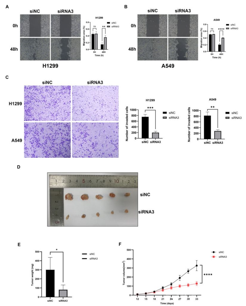 Figure 12 Down-regulating NRC-AL162632.3 inhibits LUAD migration and invasion